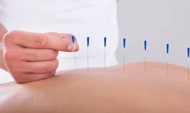 Medical Acupuncture (UK)