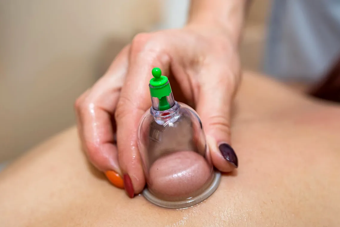Myofascial Cupping (UK)