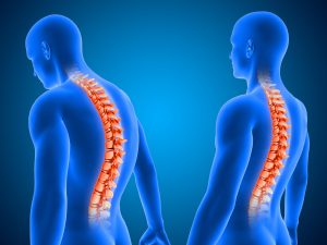 Spine and Musculoskeletal Expert